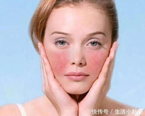 冷敷贴|夏季到来,你的肌肤准备好挑战了吗?补水攻略可不能少