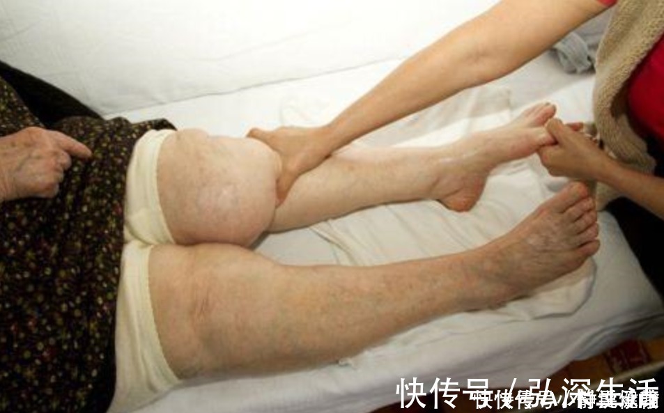 人体|腿是人体第二“心脏”，建议老年人：日常做好3件事，老得慢