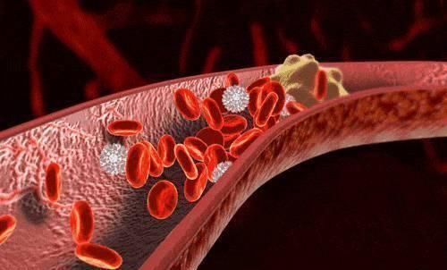 高血脂|吃什么可以“软化血管”有效的办法就一个,其他都是“忽悠”你