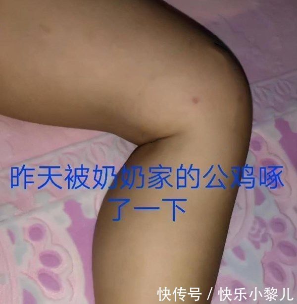 萌娃|萌娃被公鸡啄了腿,爷爷“报仇”方式很特别,网友吐槽:惹不起