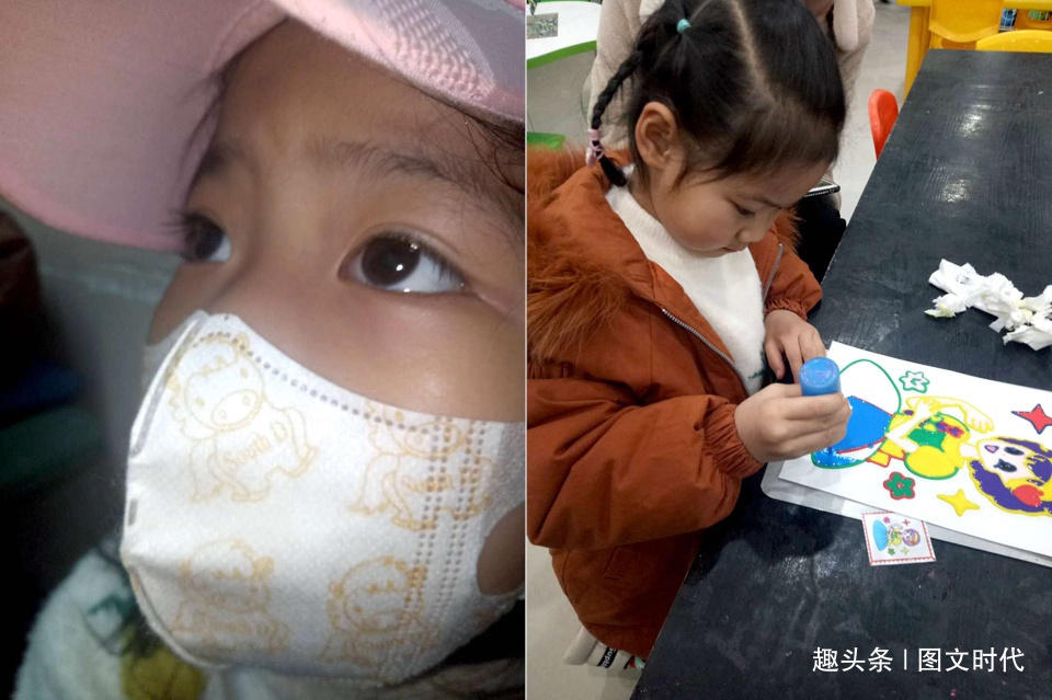 程程|6岁女童鼻子突然红肿,送医查出罕见肿瘤,妈妈含泪打掉腹中胎儿