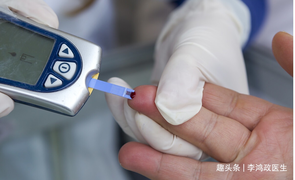 胰腺癌|女子口渴、尿多,以为是糖尿病,直到上腹部不适医生才发现是癌症