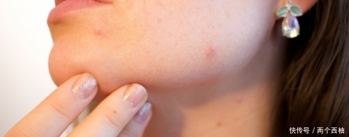 肝胆实火|龙胆泻肝汤:治疗肝火亢盛、肝胆湿热或湿热下注病症