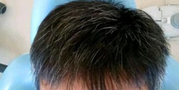 啤酒|民间一个土秘方，不管白发多严重，让你从此告别染发，存起来