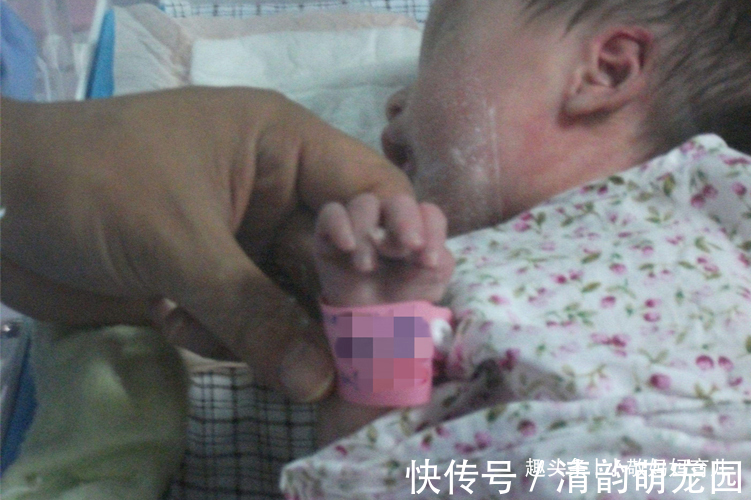 医生|宝宝出生长了“凤爪”,宝妈谎称孕期吃了鸡爪,却被医生当场揭穿