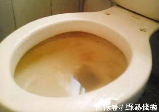 白醋|马桶用久了,黄渍顽固难清洗?撒点这“东西”,污垢异味轻松去除