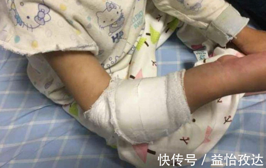 铆钉|三岁女孩一直说手臂疼,送到医院检查后,医生说你们差点后悔一生