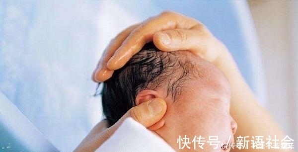 生理性黄疸|婴幼儿护肤的三大“雷区”，多少父母踩中了？早点避开孩子少受罪