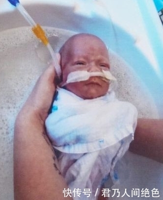 女子|女子生的孩子只有手掌大小,本以为活不久,半年过后,父母乐坏了