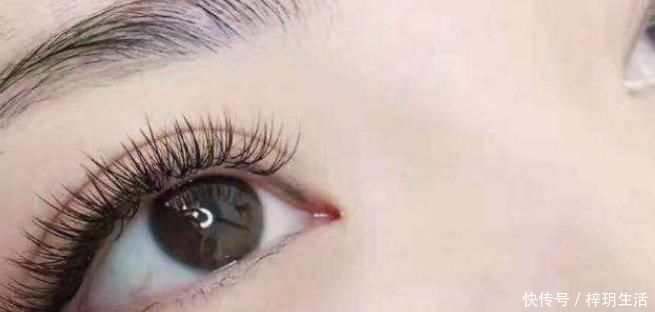 预防肝硬化|天然“强肝王”被发现，不想肝透支就多吃，肝硬化或“不告而别”