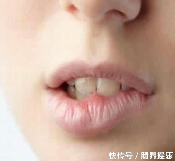 若嘴唇有这6个症状,说明身体出现了问题,看看