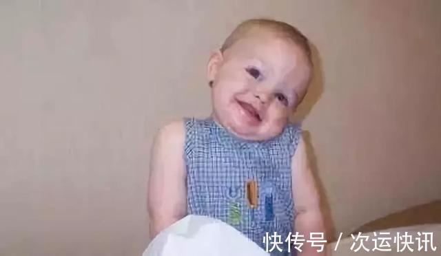 矫正|别把娃抱成了“歪脖子”!这些毁脊椎的抱姿,也许你每天都在做…