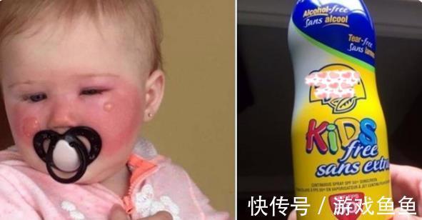 晒伤|夏天给孩子用错“防晒”伤害有多大?用我亲身经历告诫,父母注意