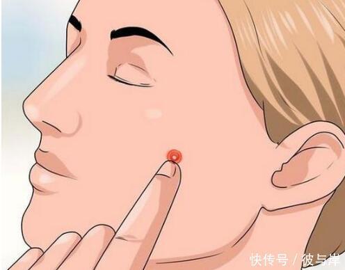 留痘印,是因为3个护理你没做好,具体指哪里?今天和你说说