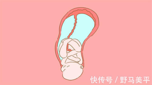 顺转剖|产妇难“顺”又改“剖”,早知道直接剖腹产!这个罪为啥要受?