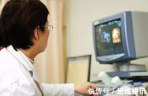 雯雯|四维彩超太难通过过来人提前做好这3件事,免得折腾太久