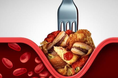 蹭蹭|高血脂真正的“源头”找到了,并非肥肉,常吃这3物,血脂蹭蹭涨