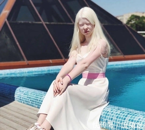 生而白首|一对罕见的“月亮姐妹”,被人嘲讽14年,拍完一组照片后惊艳众人