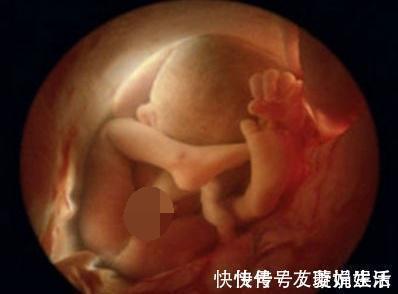 见红|身怀五个月孕妇下身”见红“误以流产,急忙到医院却让医生憋着笑