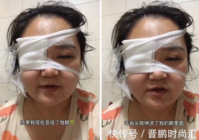 岳岳|我为你剖腹七层,你却让我变“独眼”?宝妈被娃戳眼后的善意提醒