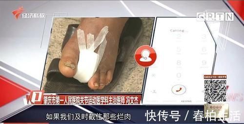 莫伯|男子脚趾受伤后竟爬出蛆虫 需做截肢手术 病情为何如此严重?