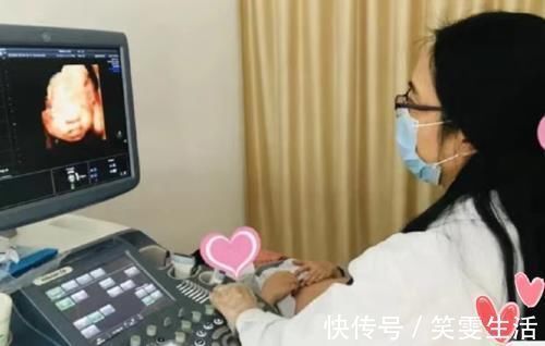 孕妈|老公陪孕妈做四维,结果不让进,为啥四维检查贴着“家属止步”?