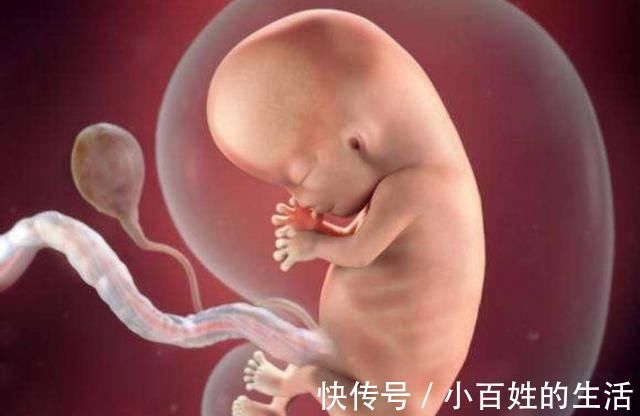 胎儿|水中分娩的宝宝，出生时会“呛水”吗？看完后感叹生命的神奇