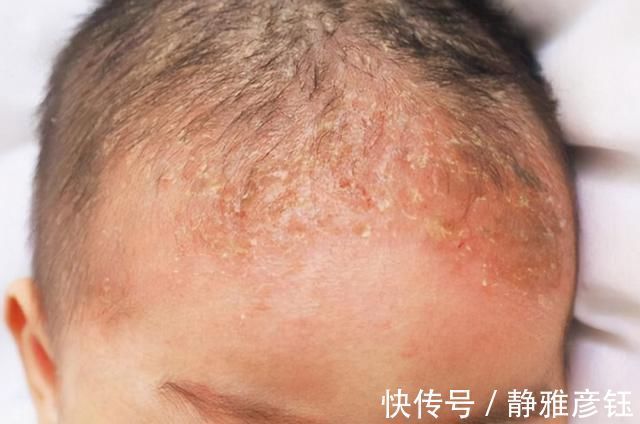 理论|发现新生儿小屁屁上有“淤青”,老公想找护士理论,最后暗暗庆幸