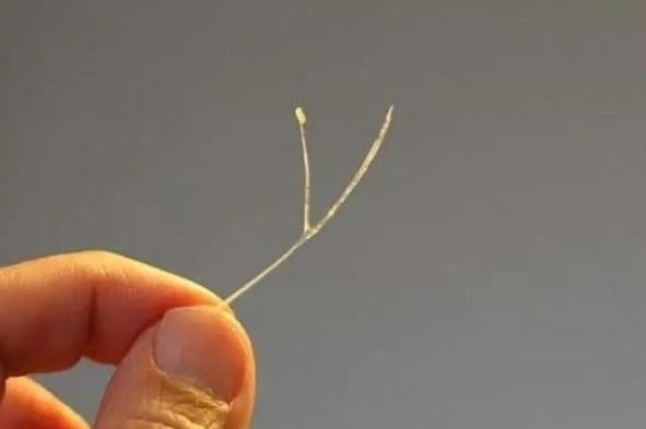 孩子|3岁孩子不小心卡了鱼刺,父母的2个果断救了他,医生真棒