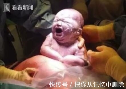 未婚夫|医生从妈妈肚子里取出一个肉球!网友:这是哪吒啊