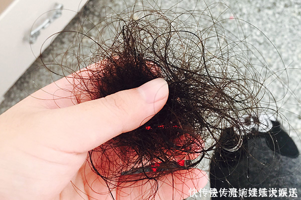 女性|女性体毛旺盛可能是四个原因导致的，你属于哪一种，建议自测