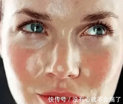 敏感肌 柔肤水、爽肤水、精华水、化妆水的区别是什么?怎么选择护肤水?