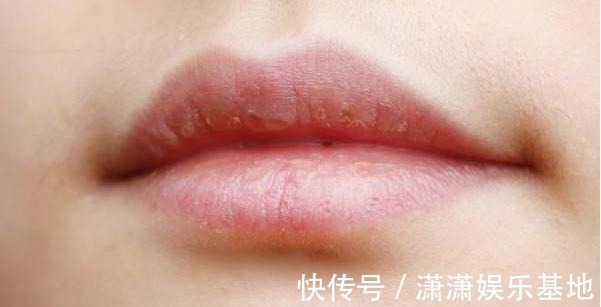 女性|女性生育能力的强弱,从脸上就能看出:只占一个,都要引起重视