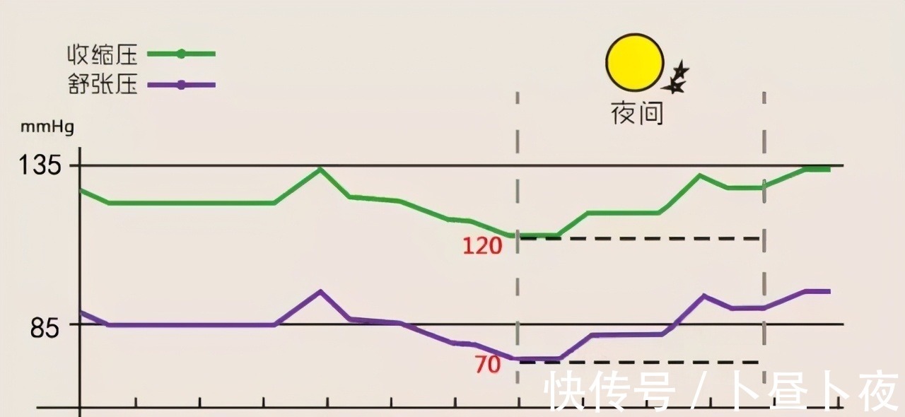 医生|高血压不吃药,如何降血压?医生告诉你这6个方法,简单又实用