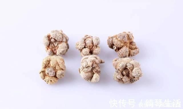 卵磷脂|脑梗的“祸根”终于揪出这5个习惯再不改,血栓很容易一堵再堵