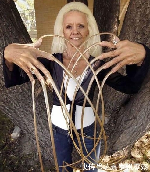 世纪 佩服!女子从上世纪开始就没剪过指甲,总长达8米已严重影响生活