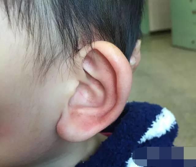 有福气|孩子脸上的这4种特征,说明将来有福气,看看你家娃占几个