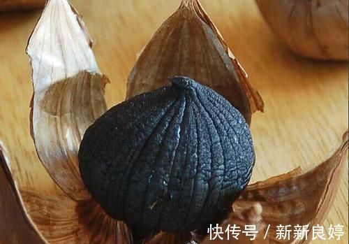 黑蒜|脑供血不足最怕的“解药”,不是运动,而是它,后悔现在才知道