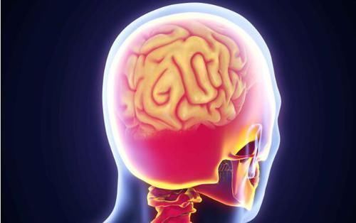 肌肉痉挛|走路时,腿突然发软甚至跌倒,是什么情况?这5个因素,别大意