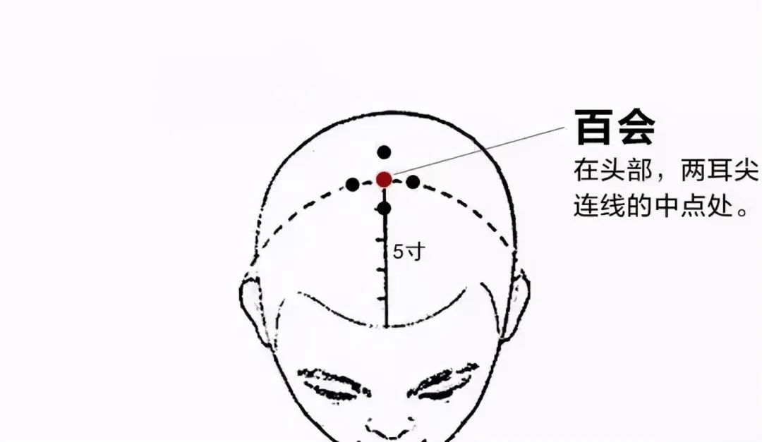 斑秃|国医大师贺普仁：火针治疗斑秃经验