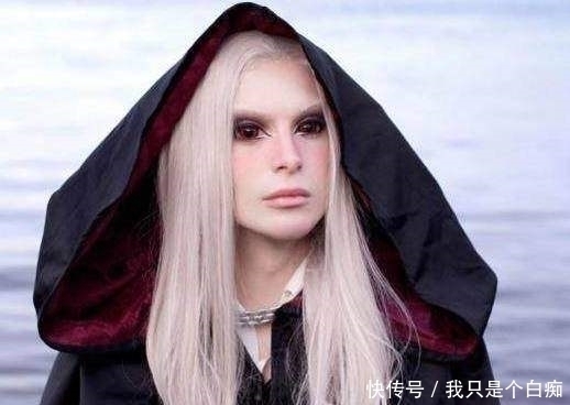整容|男子为变成精灵王子,削尖耳朵整成怪物,网友:整容前太帅了