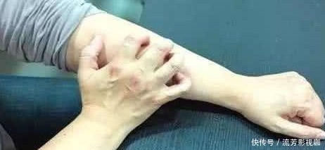 身体发出5个信号,或是糖尿病找上门,抓紧降糖