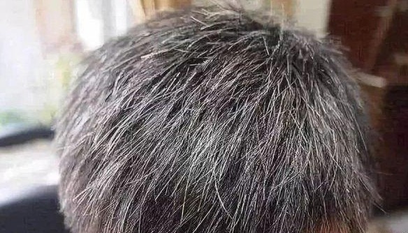 长白头发|白醋用此方法操作，白发不管多少，头发自然黑如润墨不再染发！