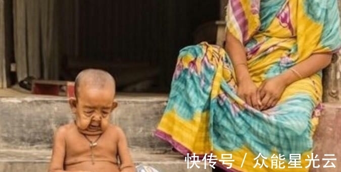 巴耶塞特|印度13岁少女嫁给亲哥哥,当他们孩子出生后,一家人大闹医院