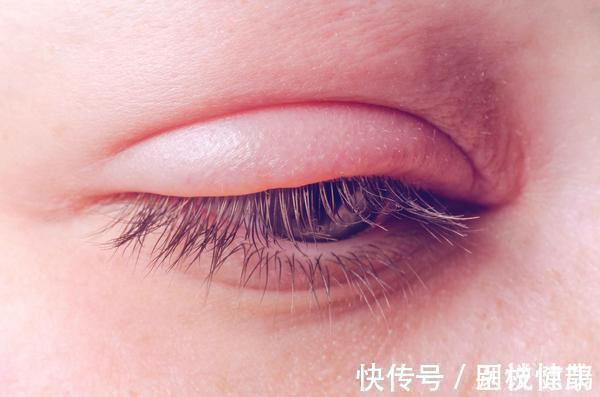 异常|糖尿病患者,身体出现3个异常,要小心糖尿病肾病找上门了!