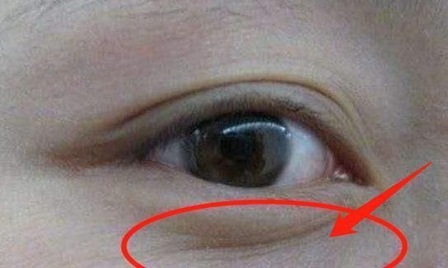 脸是子宫的“晴雨表”,若出现4大不良异常,子宫或已“稀巴烂”