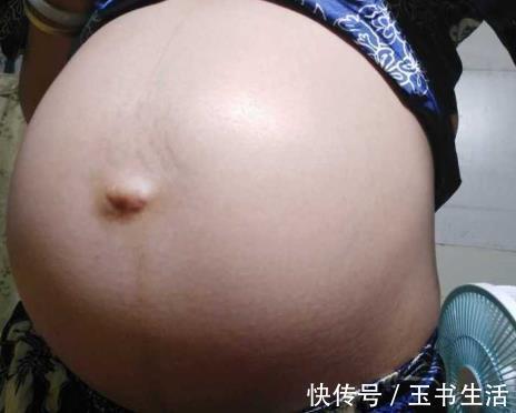 准妈妈|准妈妈太粗略,孕期陋习百出,孕26周被要求保胎