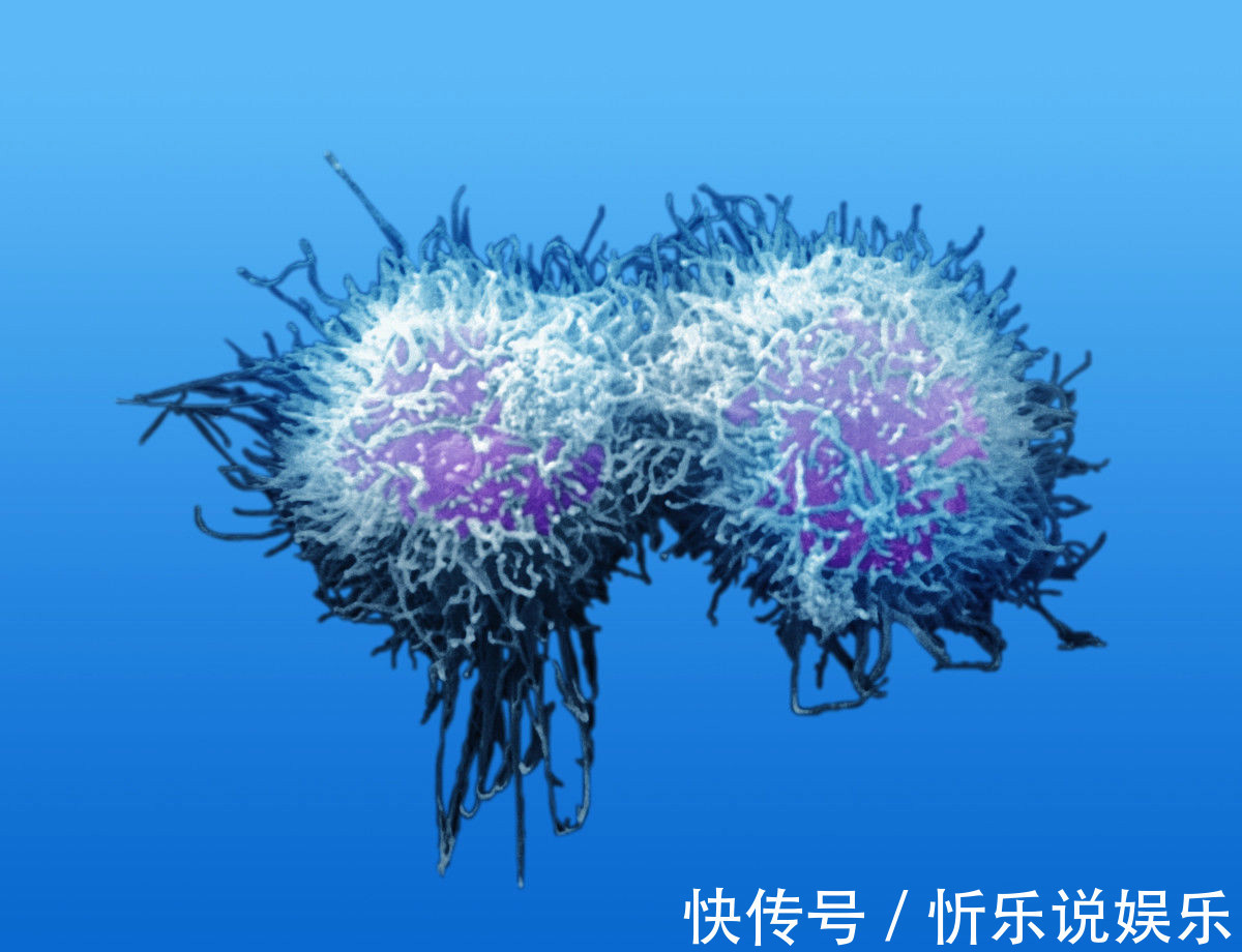 进展期|三个症状不断出现，十有八九是进展期癌症，你却一拖再拖