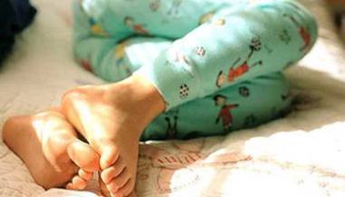 肺栓塞|体内有没有血栓,看看你的手和脚就知道