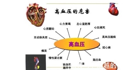 终生吃药|高血压都必须终生吃药辟谣并非如此，这些高血压不用终生吃药